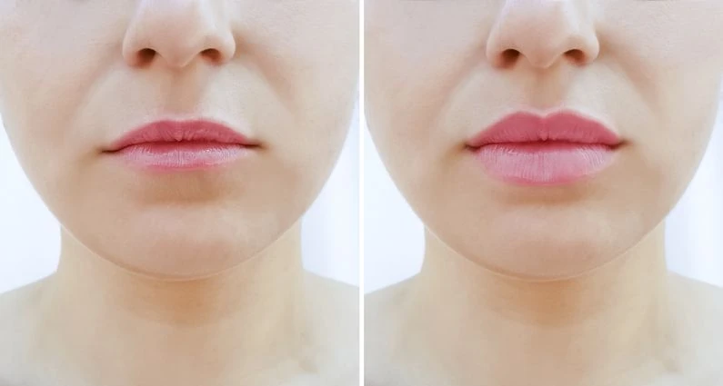 Zwei Lippenansichten nebeneinander